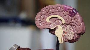 Photo Brain diagram